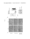 COMPOSITION COMPRISING EXPRESSION OR ACTIVITY INHIBITORS OF NINJURIN1 FOR     THE PREVENTION AND TREATMENT OF INFLAMMATORY DISEASE diagram and image