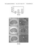 COMPOSITIONS AND METHODS RELATED TO ANTIBODIES TO STAPHYLOCOCCAL PROTEINS     ISDA OR ISDB diagram and image