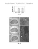 COMPOSITIONS AND METHODS RELATED TO ANTIBODIES TO STAPHYLOCOCCAL PROTEINS     ISDA OR ISDB diagram and image