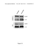 MODULATION OF LRCH4 ACTIVITY AND THERAPEUTIC APPLICATION THEREOF diagram and image