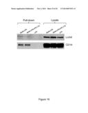 MODULATION OF LRCH4 ACTIVITY AND THERAPEUTIC APPLICATION THEREOF diagram and image