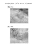 SCAFFOLD FOR TISSUE REGENERATION IN MAMMALS diagram and image