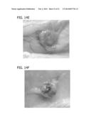 SCAFFOLD FOR TISSUE REGENERATION IN MAMMALS diagram and image