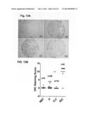 CDK8-CDK19 SELECTIVE INHIBITORS AND THEIR USE IN ANTI-METASTATIC AND     CHEMOPREVENTATIVE METHODS FOR CANCER diagram and image