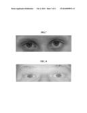 Compositions and Methods for Eye Whitening diagram and image