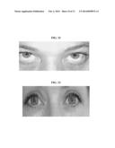 Compositions and Methods for Eye Whitening diagram and image