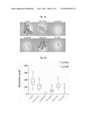 NOVEL PANCREATIC CANCER BIOMARKER USING THE CHARACTERISTICS OF PANCREATIC     CANCER STEM CELLS, AND USE THEREOF diagram and image