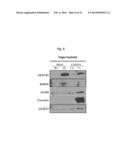 NOVEL PANCREATIC CANCER BIOMARKER USING THE CHARACTERISTICS OF PANCREATIC     CANCER STEM CELLS, AND USE THEREOF diagram and image