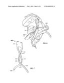 PATIENT-MANIPULABLE DEVICE FOR AMELIORATING INCONTINENCE diagram and image