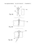 DEVICE, SYSTEM AND METHODS FOR INTRODUCING SOFT TISSUE ANCHORS diagram and image