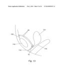 DEVICE, SYSTEM AND METHODS FOR INTRODUCING SOFT TISSUE ANCHORS diagram and image