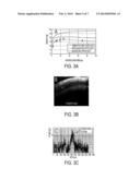 OPTICAL COHERENCE TOMOGRAPHY SYSTEM AND METHOD FOR REAL-TIME SURGICAL     GUIDANCE diagram and image