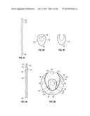 DILATION SYSTEM diagram and image