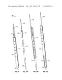 DILATION SYSTEM diagram and image