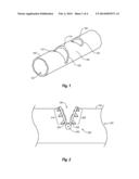 HINGED TISSUE SUPPORT DEVICE diagram and image