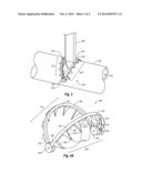 HINGED TISSUE SUPPORT DEVICE diagram and image