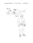 BARIATRIC INSTRUCMENT OR ACCESSORY WITH SENSORS diagram and image