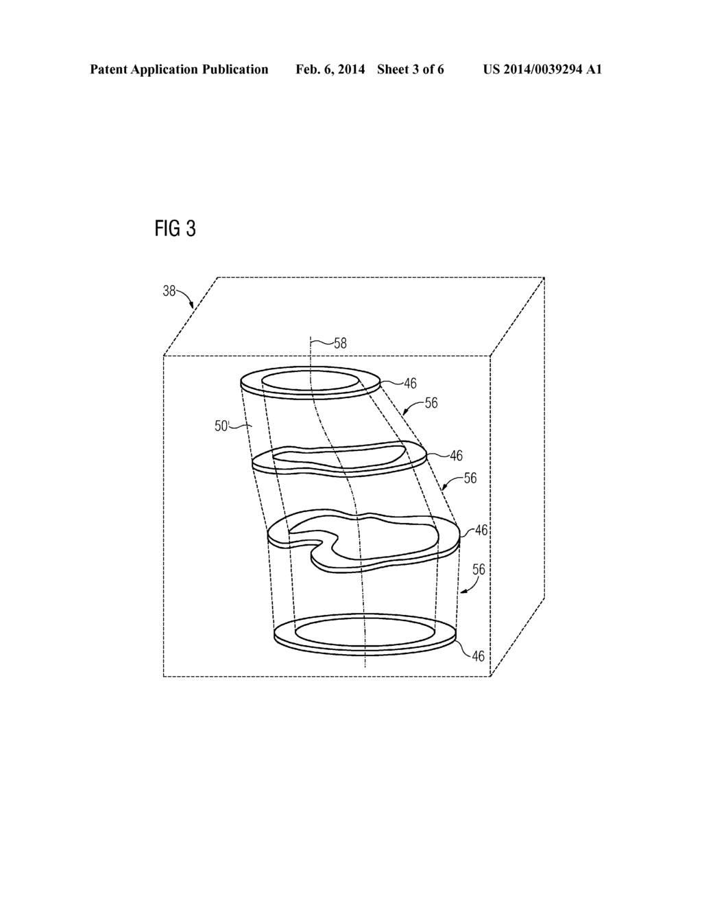 CATHETER WITH ULTRASOUND SENSOR AND METHOD FOR CREATING A VOLUME GRAPHIC     BY MEANS OF THE CATHETER - diagram, schematic, and image 04