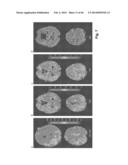 ULTRASONIC SYSTEM FOR ASSESSING TISSUE SUBSTANCE EXTRACTION diagram and image