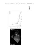 ULTRASONIC SYSTEM FOR ASSESSING TISSUE SUBSTANCE EXTRACTION diagram and image