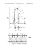 DEVICE FOR THE ANALYSIS OF AN ENDOCARDIAC SIGNAL OF ACCELERATION diagram and image