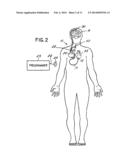 VAGAL NERVE STIMULATION TECHNIQUES FOR TREATMENT OF EPILEPTIC SEIZURES diagram and image