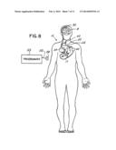 VAGAL NERVE STIMULATION TECHNIQUES FOR TREATMENT OF EPILEPTIC SEIZURES diagram and image