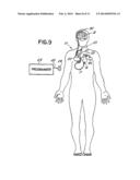 VAGAL NERVE STIMULATION TECHNIQUES FOR TREATMENT OF EPILEPTIC SEIZURES diagram and image