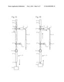 Balloon Catheter Systems for Delivery of Dry Drug Delivery Vesicles to a     Vessel in the Body diagram and image