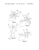 SECUREMENT DEVICE diagram and image