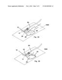 SECUREMENT DEVICE diagram and image