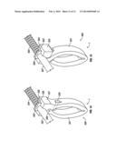 Biomaterial Dispensing Device diagram and image