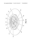 Compact Spring Inserter For Drug Delivery Infusion Set diagram and image