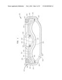 REDUCED SIZE IMPLANTABLE PUMP diagram and image