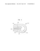 REDUCED SIZE IMPLANTABLE PUMP diagram and image