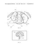 ENERGETIC MODULATION OF NERVES diagram and image