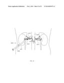 ENERGETIC MODULATION OF NERVES diagram and image