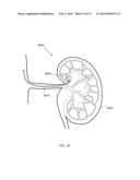 ENERGETIC MODULATION OF NERVES diagram and image