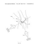 ENERGETIC MODULATION OF NERVES diagram and image