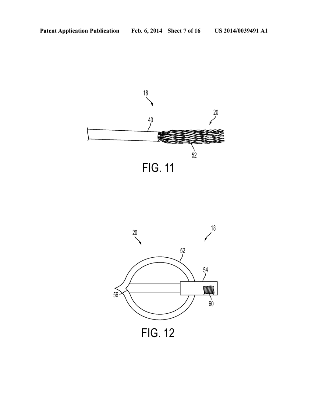 FLEXIBLE EXPANDABLE ELECTRODE AND METHOD OF INTRALUMINAL DELIVERY OF     PULSED POWER - diagram, schematic, and image 08