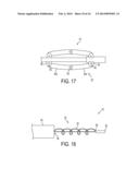 FLEXIBLE EXPANDABLE ELECTRODE AND METHOD OF INTRALUMINAL DELIVERY OF     PULSED POWER diagram and image