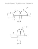 FLEXIBLE EXPANDABLE ELECTRODE AND METHOD OF INTRALUMINAL DELIVERY OF     PULSED POWER diagram and image