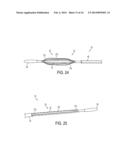 FLEXIBLE EXPANDABLE ELECTRODE AND METHOD OF INTRALUMINAL DELIVERY OF     PULSED POWER diagram and image