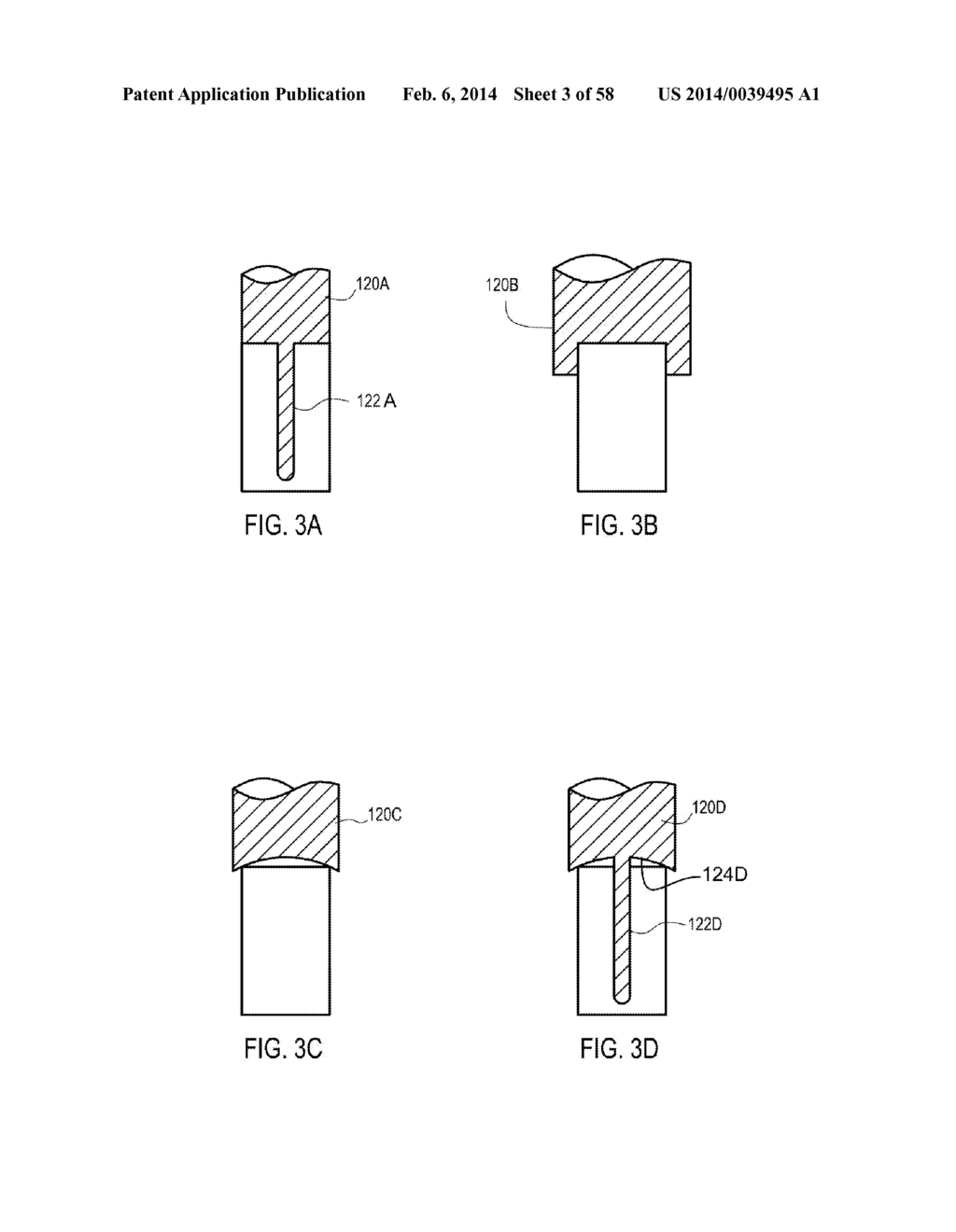 METHODS OF SECURING A FASTENER - diagram, schematic, and image 04