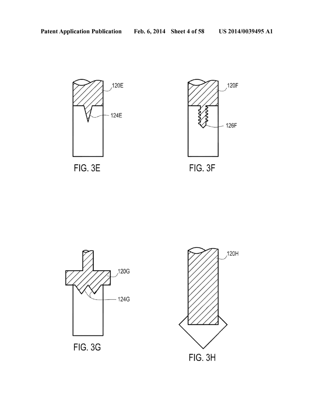 METHODS OF SECURING A FASTENER - diagram, schematic, and image 05