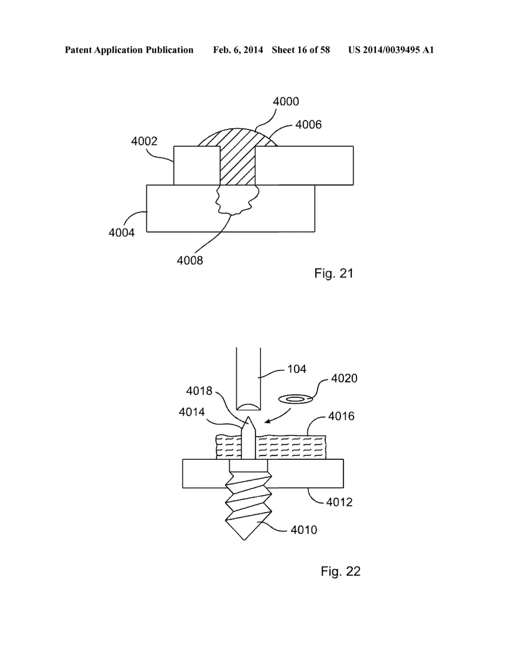 METHODS OF SECURING A FASTENER - diagram, schematic, and image 17