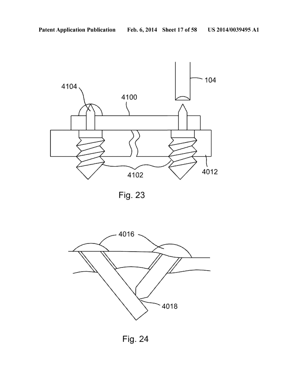 METHODS OF SECURING A FASTENER - diagram, schematic, and image 18