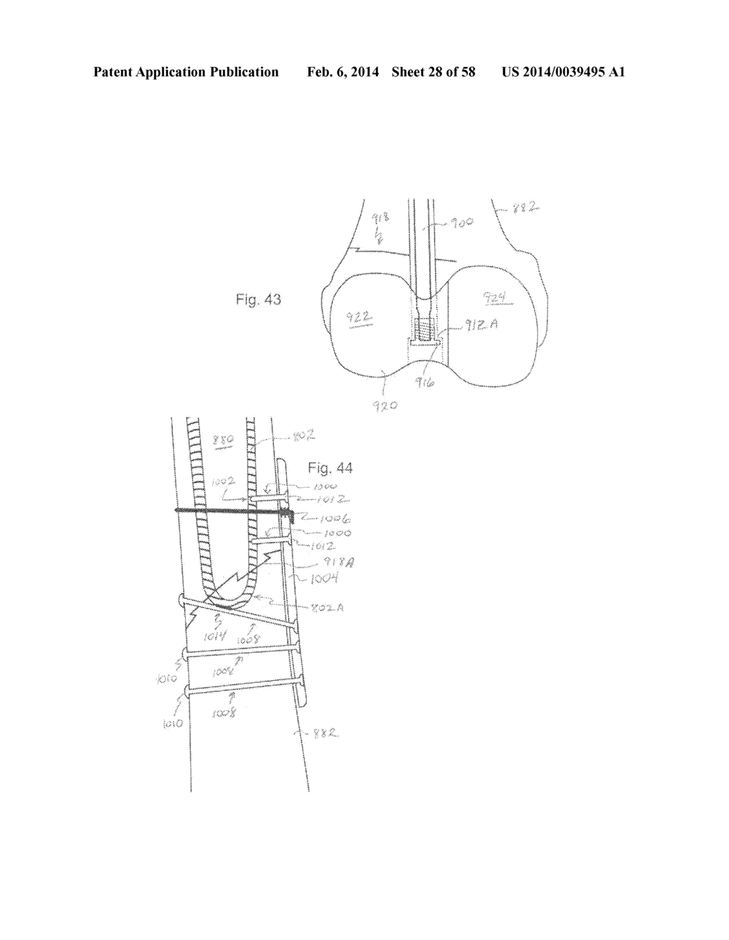 METHODS OF SECURING A FASTENER - diagram, schematic, and image 29