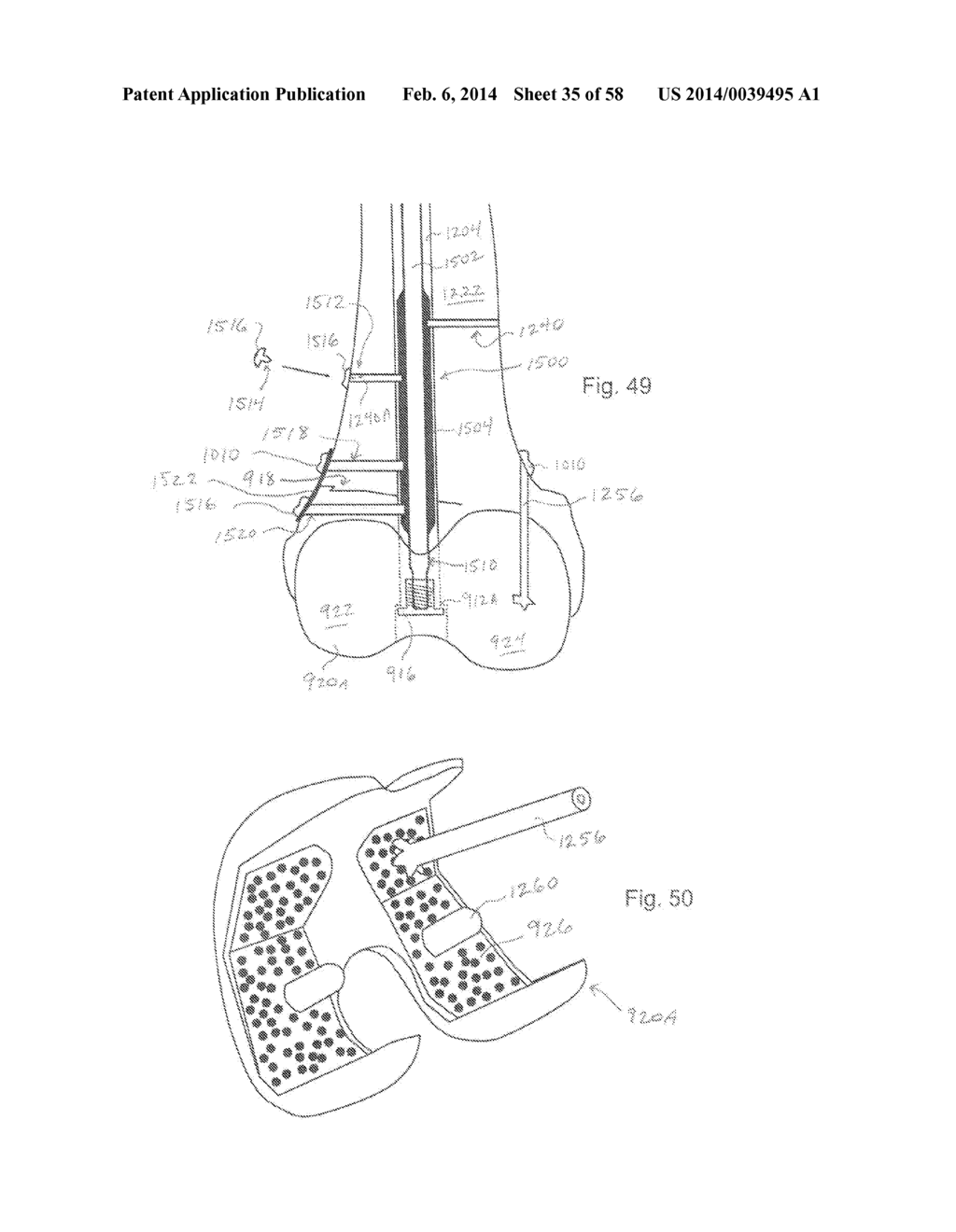 METHODS OF SECURING A FASTENER - diagram, schematic, and image 36