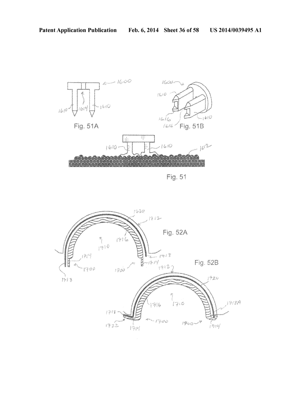 METHODS OF SECURING A FASTENER - diagram, schematic, and image 37